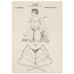 Brassiere patent drawing by M P Jacob.
