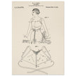 Brassiere patent drawing by M P Jacob.