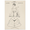 Brassiere patent drawing by M P Jacob.