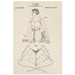 Brassiere patent drawing by M P Jacob.