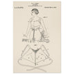 Brassiere patent drawing by M P Jacob.