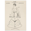 Brassiere patent drawing by M P Jacob.